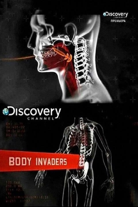 Series “Body Invaders” — cover